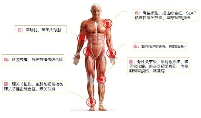 骨性关节.jpg